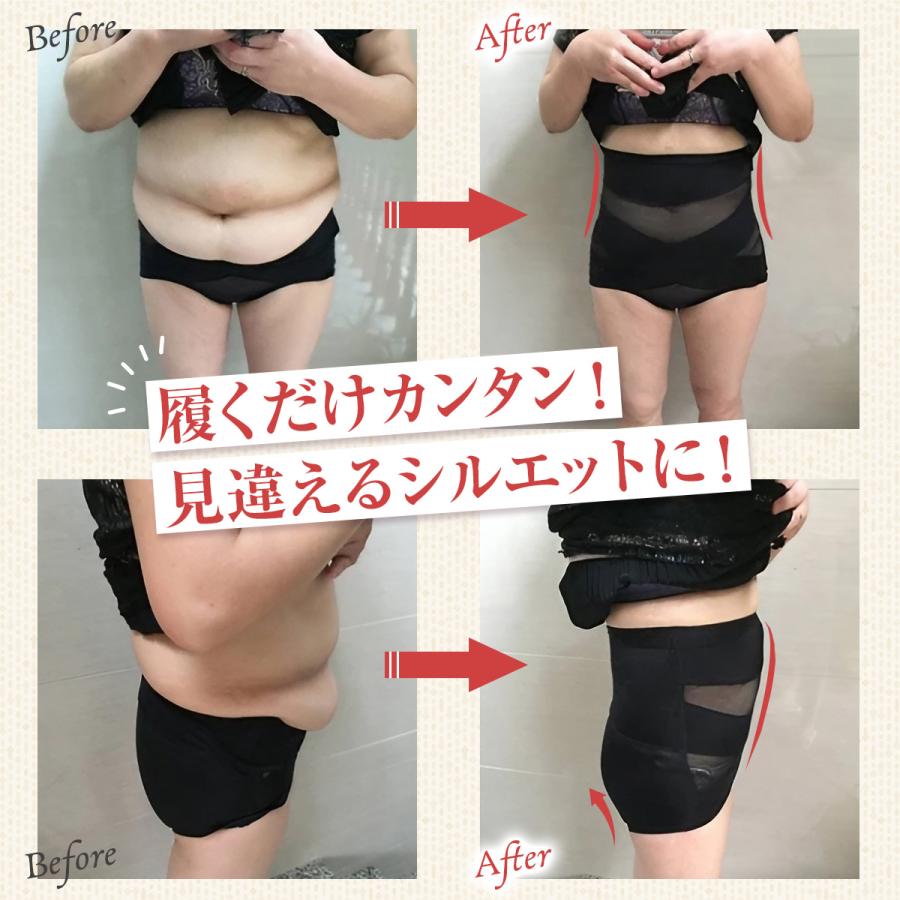 ガードルショーツ 補正下着 ショーツ 産後 骨盤補正 ショートガードル ぽっこりお腹 ダイエット ショーツガードル お腹 引き締め 細見え 骨盤ガードル |  | 15