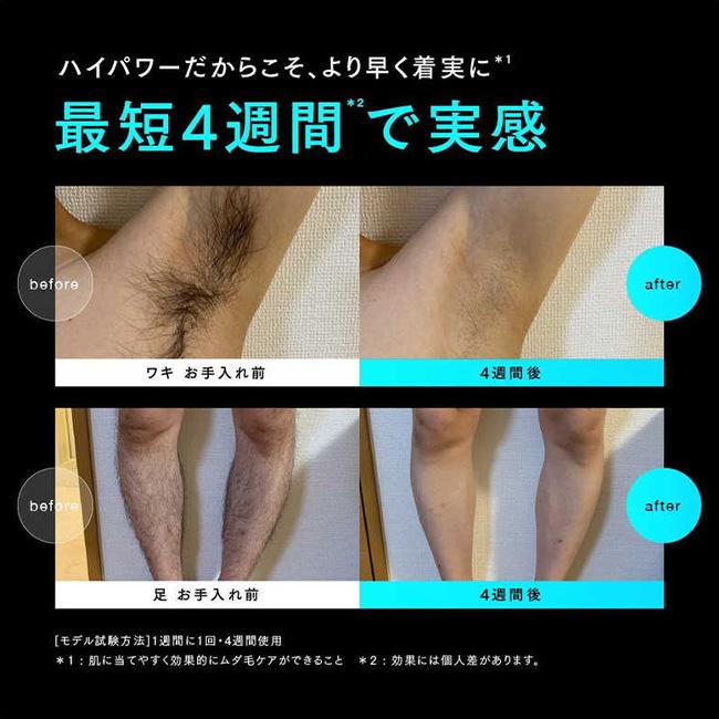 マイトレックス ミライ 光美容器 家庭用脱毛器 IPL 光脱毛 家庭用 VIO