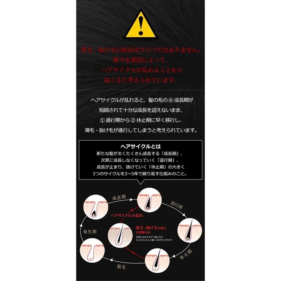 3つの発毛理論で発毛力を引き出す 薬用育毛剤 プレミアムグローパワー 育毛剤 発毛剤 育毛トニック Gpower 001 アールスタイルストア 通販 Yahoo ショッピング