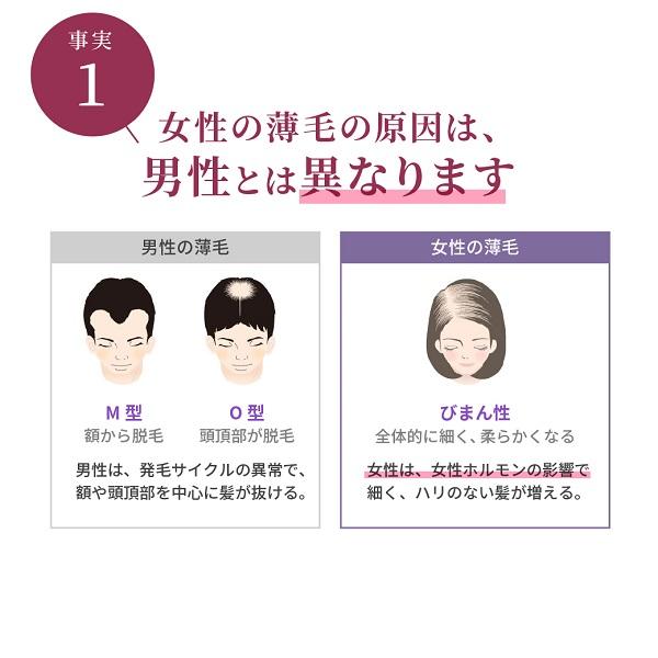 スカルプD ボーテ 全額返金保証 女性用 育毛剤 レディース
