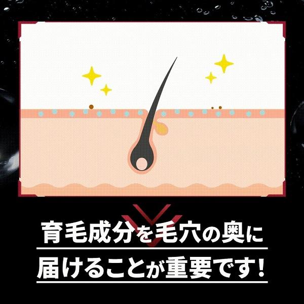 スカルプD 薬用 育毛 トニック 育毛剤 メンズ 男性 男性用 スカルプ 発