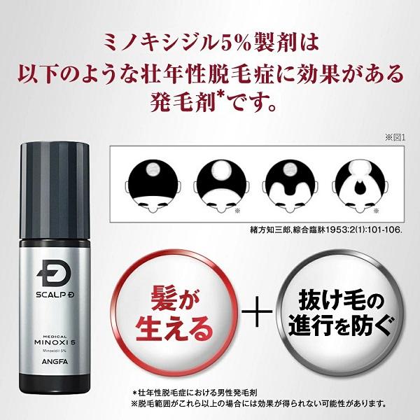 スカルプD メディカルミノキ5 第1類医薬品 発毛剤 ミノキシジル