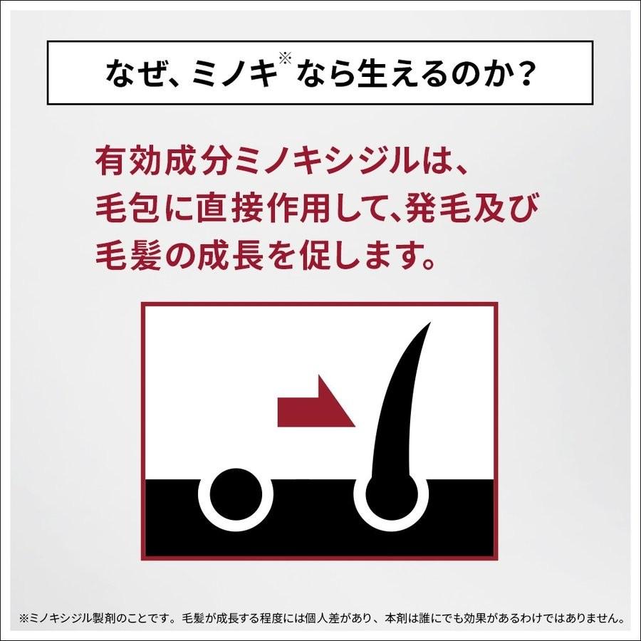 ポイント15倍 第1類医薬品 発毛剤 ミノキシジル 5％ メディカルミノキ５ 3本セット 問診8の「上記※1」は商品画像2枚目 育毛剤 スカルプD 最安値 育毛｜angfa｜06