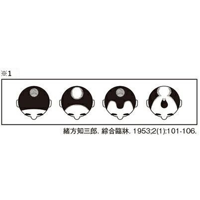 発毛剤 第1類医薬品 スカルプｄ メディカルミノキ５ 4本セット 問診9の 上記 1 は商品画像2枚目にございます 発毛剤 育毛剤 スカルプdのアンファーストア 通販 Paypayモール