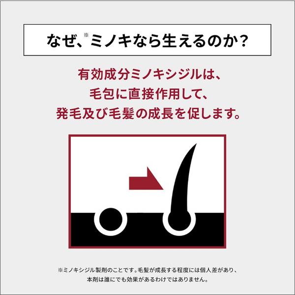 第1類医薬品 発毛剤 ミノキシジル AGA治療費3万円を補償 メディカルミノキ5 プレミアム 4本問診9の「上記※1」は商品画像2枚目 スカルプDの画像