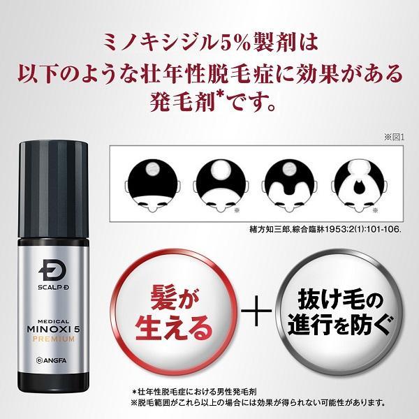 スカルプD メディカルミノキ5 第1類医薬品 発毛剤 ミノキシジル