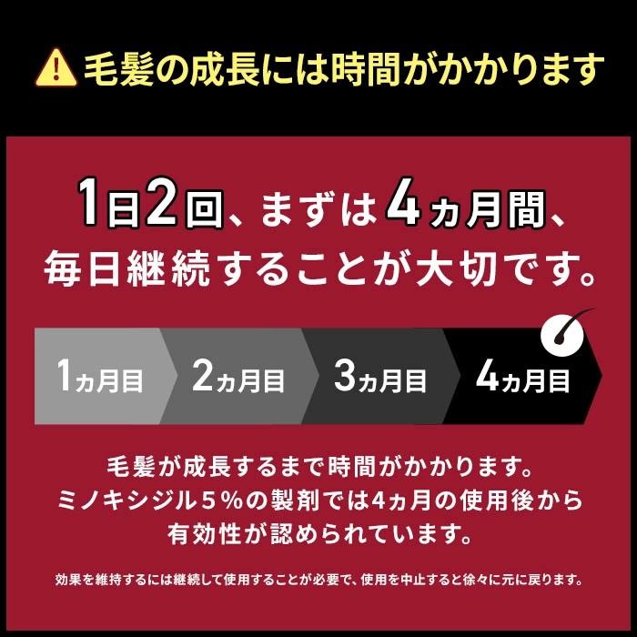 第1類医薬品 発毛剤 ミノキシジル メディカル ミノキ5プレミアム3本+シャンプー+コンディショナー 超脂性肌用 5% 男性用 最安値 育毛 男性 メンズ_9