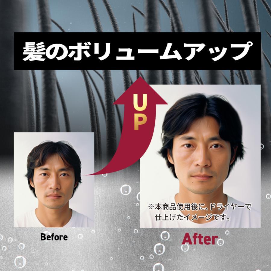 スカルプD シャンプー メンズ 薬用 スカルプ シャンプー ドライ 乾燥肌用 メンズ 人気 ヘアケア ケア 男性用 シャンプー ボトル アンファー｜angfa｜04