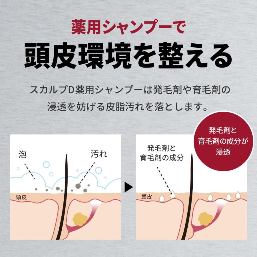 シャンプー スカルプd ストロングオイリー発毛促進3点セット 薬用スカルプシャンプー パック 薬用育毛スカルプトニック 育毛剤 メンズ スカルプdのアンファーストア 通販 Paypayモール