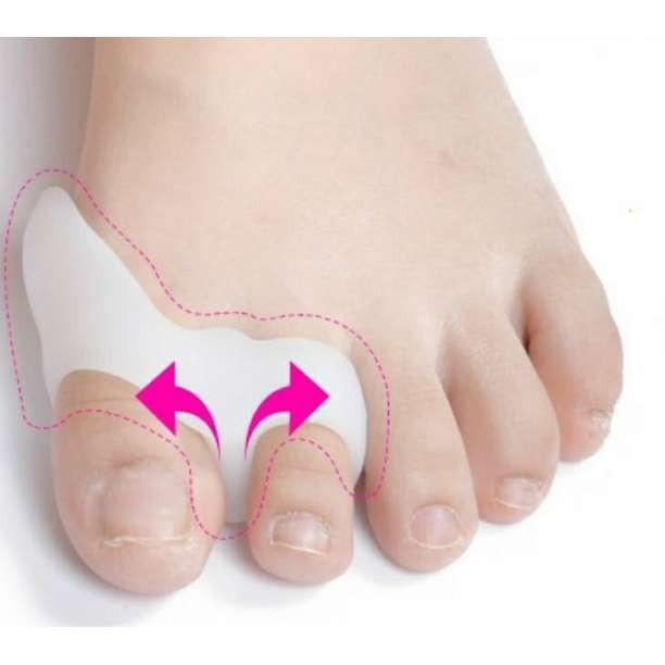 外反母趾 サポーター 2個セット シリコン 親指 足 保護 靴 矯正 パッド 白 |  | 02