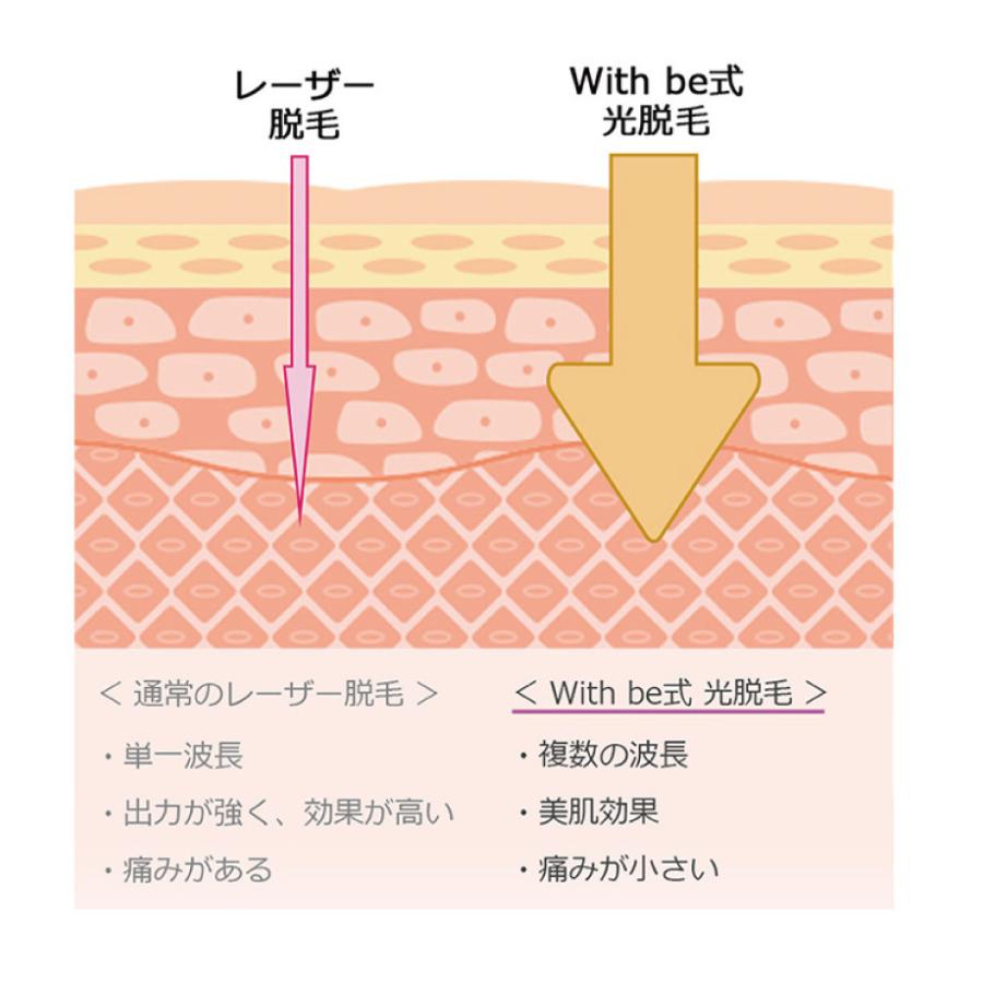 with be 光脱毛器 