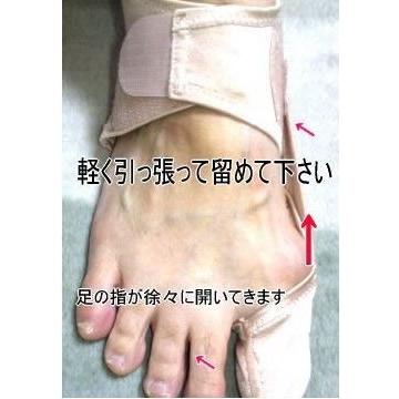 外反母趾サポーター「ぼっち君」坂本外反母趾研究所開発 両足分（1ペア
