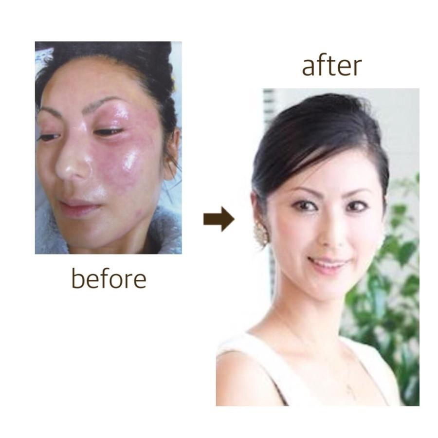 アピココbeeビューティーセラム 50g ギフトラッピング 顔に塗るはちみつ 生はちみつ美容液 ラッピング 誕生日 日焼け止め 酵素 はちみつスキンケア ギフト Honey04 アピココはちみつ美容yahoo 店 通販 Yahoo ショッピング