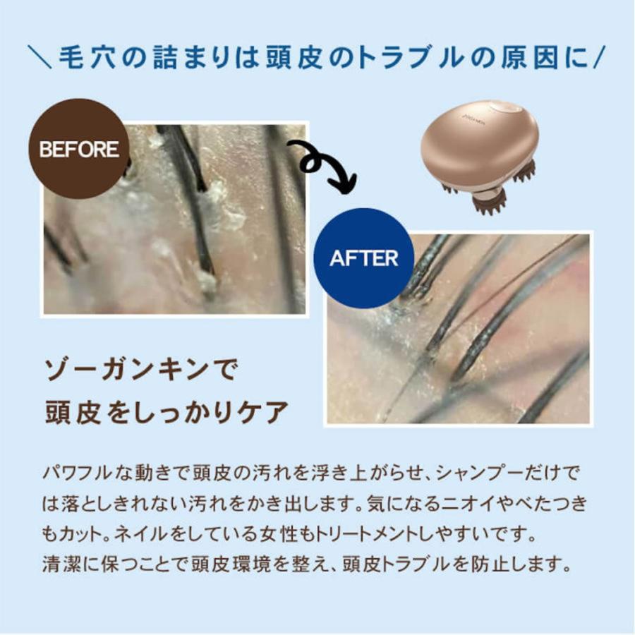 頭皮ケア マッサージ EMS スカルプケア ゾーガンキンスカルプ 頭皮ケア マッサージ EMS スカルプケア ゾーガンキンスカルプ