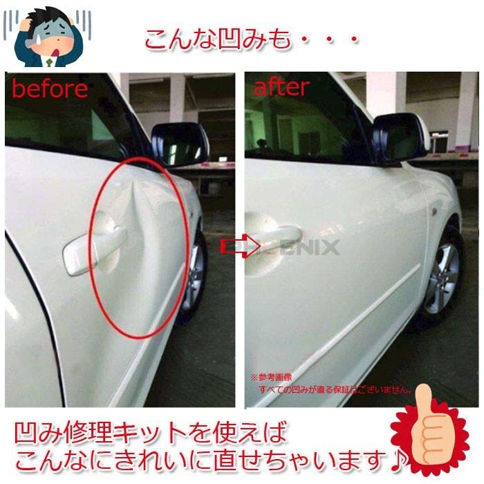 車 家電 など 修理 修繕 工具 ブリッジ型 引っ張り工具 板金工具 Diy デントリペアツール バキューム リフター 凹み直し Chb Aiai 通販 Yahoo ショッピング