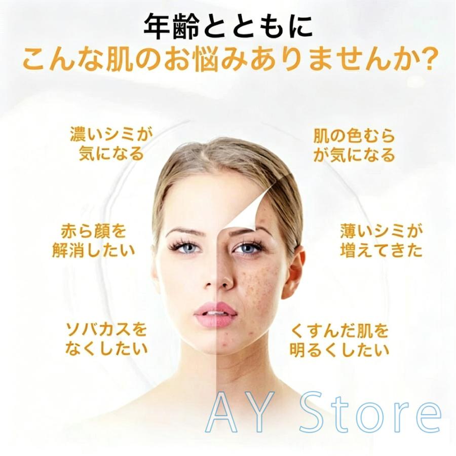 【速報】お肌の気になる部分に！低周波美顔機シミ取りホクロ取り新品未使用 ピコレーザー 美顔器 美容機器 自宅 家庭用 レーザーペン シミ取り
