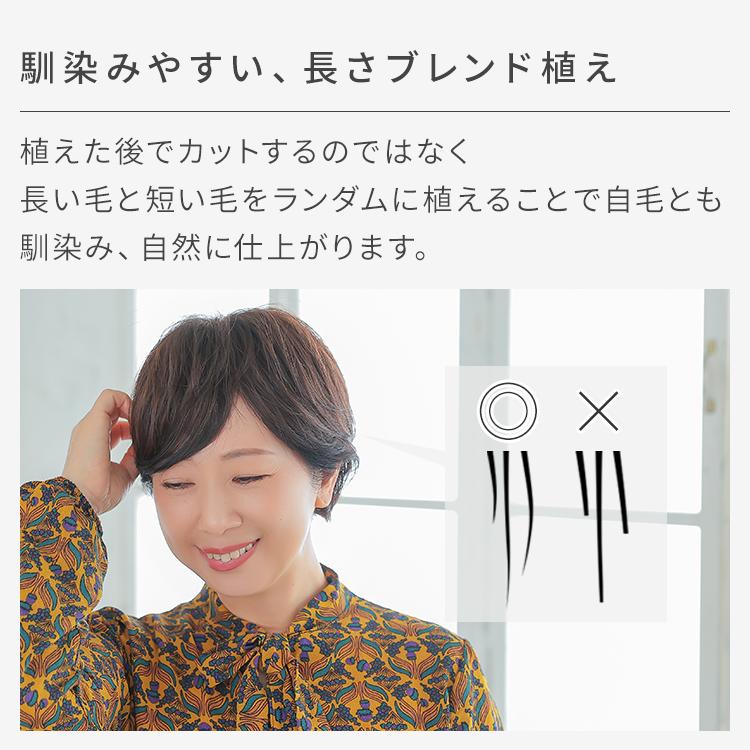AQUADOLL 部分ウィッグ 頭頂部 人毛 分け目 ヘアピース 自然 AQUADOLL 部分ウィッグ 頭頂部 人毛 分け目 ヘアピース 自然