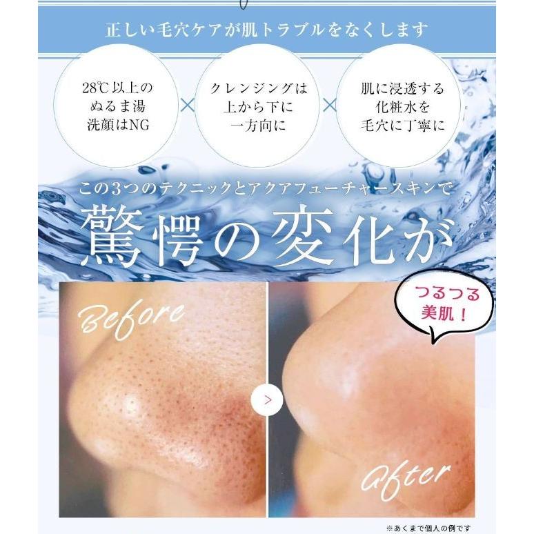 アクアフューチャースキン・ゴールド【人気No.1】の画像