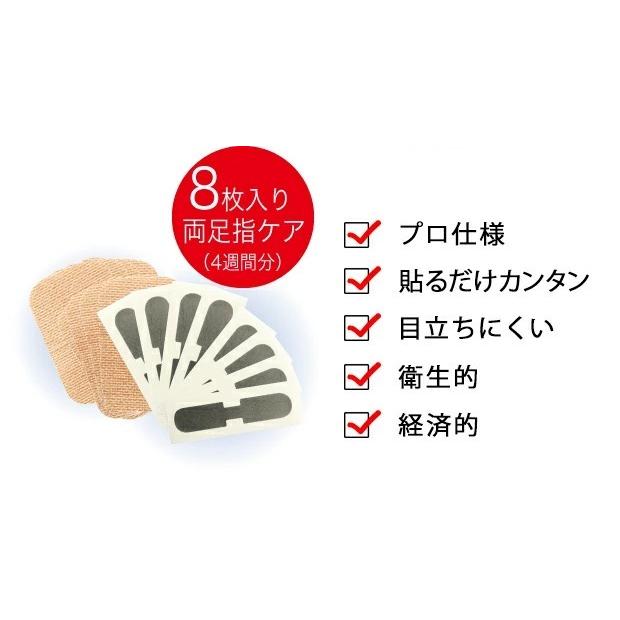 巻き爪 矯正 ワイヤー プレート テープ 巻き爪ワイヤー 巻き爪プレート