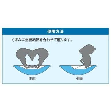 ニシ・スポーツ（NISHI） ケアディスク NT7990 ストレッチ : アラスポ