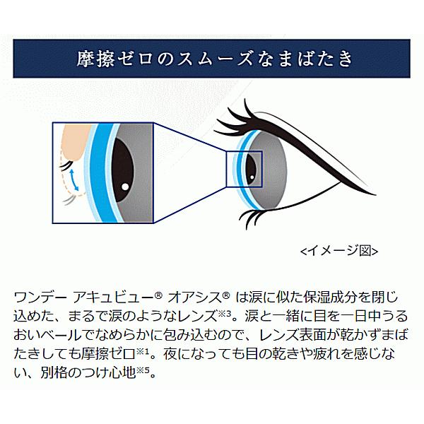 ワンデーアキュビューオアシス乱視用 コンタクトレンズ ジョンソンエンドジョンソン ワンデー トーリック 遠視用 | ACUVUE | 10