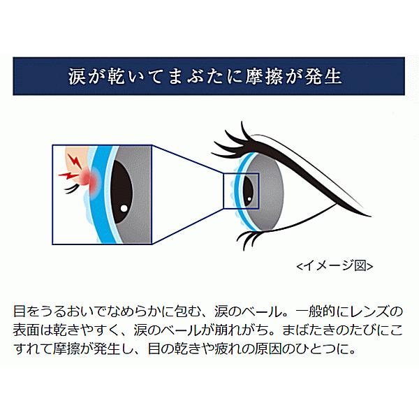 ワンデーアキュビューオアシス乱視用 コンタクトレンズ ジョンソンエンドジョンソン ワンデー トーリック 遠視用 | ACUVUE | 09