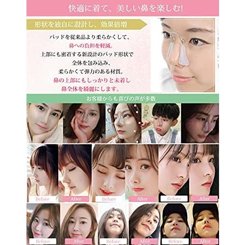 鼻筋美容師 ノーズクリップ 美鼻セレブ 鼻筋セレブ 鼻高く 美鼻 鼻筋矯正 最新進化強力版 美鼻矯正器具 鼻痩せ 鼻小さく 団子鼻 豚鼻 低い鼻 小鼻 S Arika 通販 Yahoo ショッピング