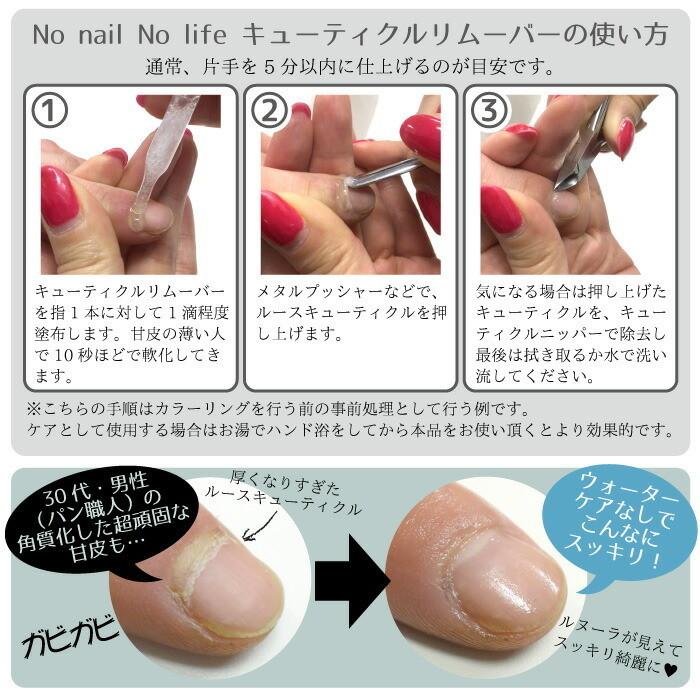 キューティクル リムーバー 20ml スポイトタイプ ノーネイル ノー