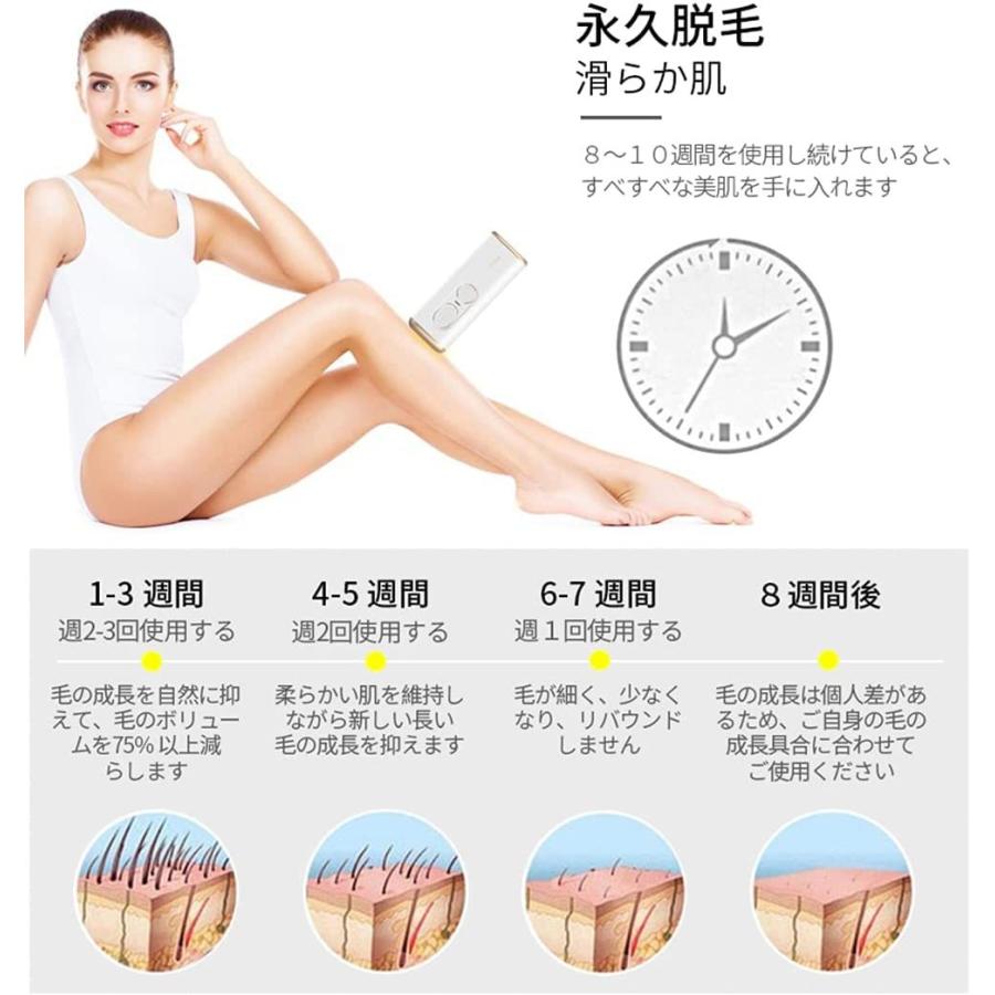 脱毛器　　IPL光子若肌脱毛器　夏準備！ Amazon | 脱毛器 【国内サロン級＆夏向け独創モデル】 IPLパルス技術
