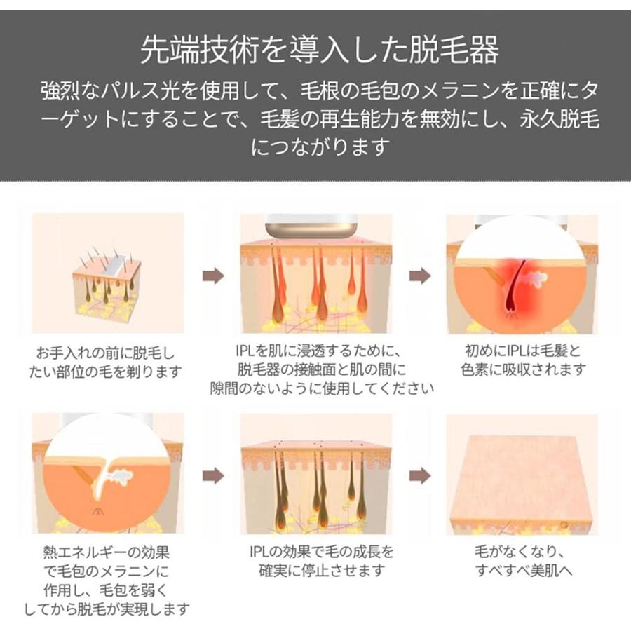 脱毛器　　IPL光子若肌脱毛器　夏準備！ Amazon | 脱毛器 【国内サロン級＆夏向け独創モデル】 IPLパルス技術