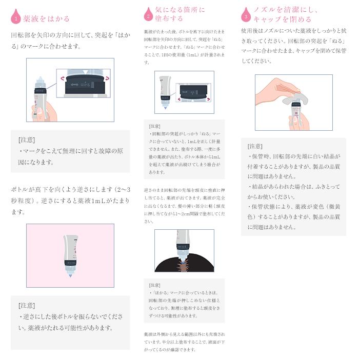 アートネイチャー 第1類医薬品 発毛剤 育毛剤 発毛 発毛促進 女性用