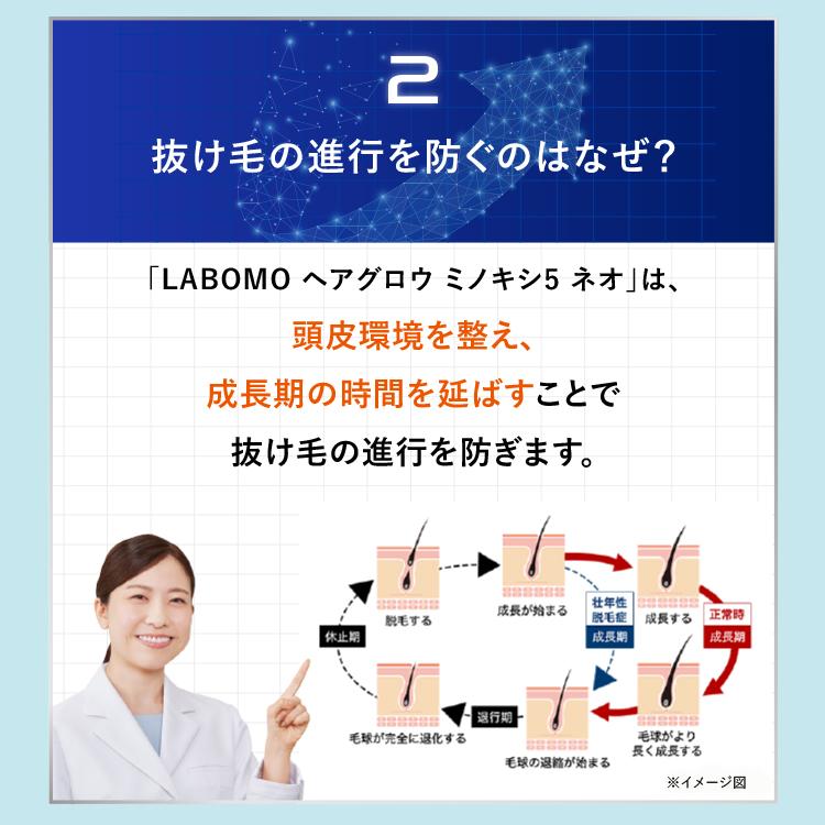 アートネイチャー 第1類医薬品 発毛剤 育毛剤 発毛促進 男性用 AGA
