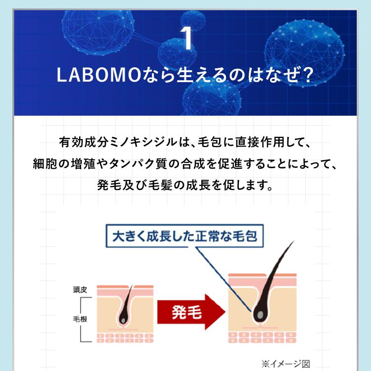 アートネイチャー 第1類医薬品 発毛剤 育毛剤 発毛促進 男性用 AGA