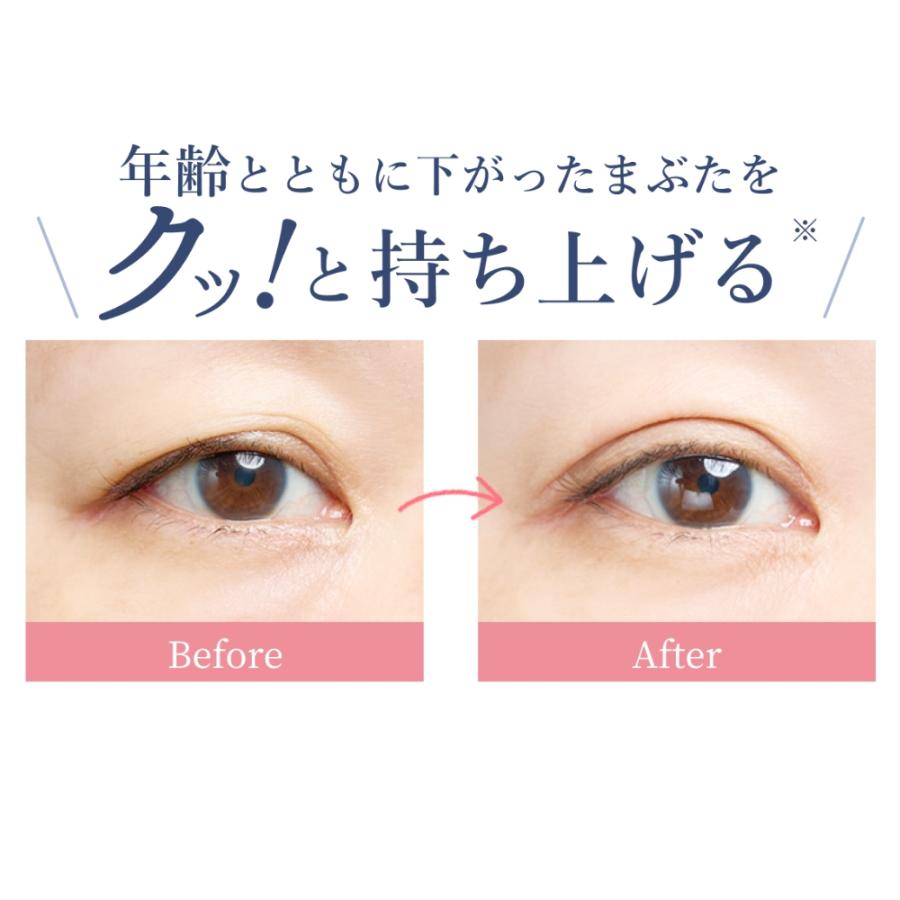 Mezaik メザイク アイクット 接着リフティングタイプ 二重まぶた