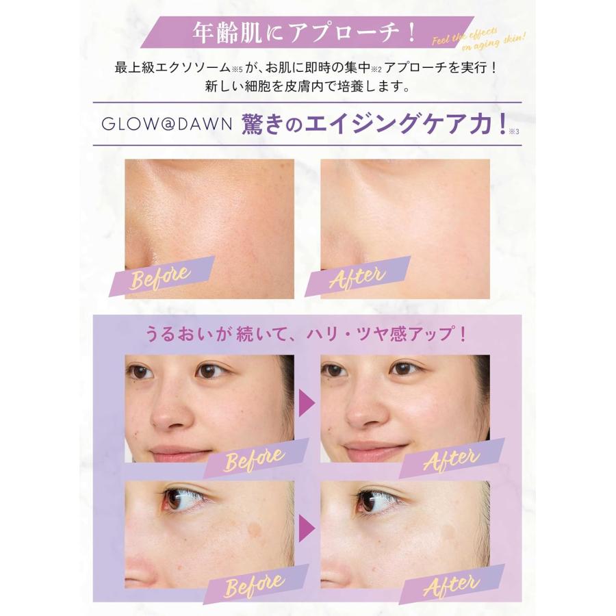 定価2750円×3個セット】GLOW@DAWN（グローアットゾーン）1st