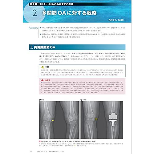 TKA・UKA 人工膝関節置換術パーフェクト?人工膝関節全置換術・人工膝関節単顆置換術の基本とコツ approach TKA 術前 手術の目標 medial parapatellar