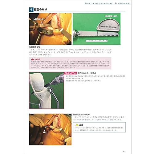 TKA・UKA 人工膝関節置換術パーフェクト?人工膝関節全置換術・人工膝関節単顆置換術の基本とコツ approach TKA 術前 手術の目標 medial parapatellar