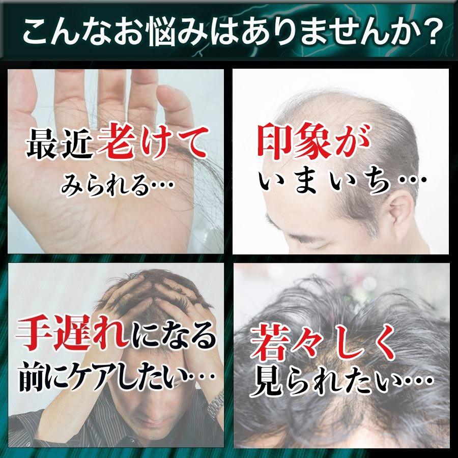 ノコギリヤシ サプリ ケラチン 7500mg ノコギリヤシ 2250mg 亜鉛 大豆イソフラボン 亜鉛 男性 90粒 Black Up Energy |  | 08