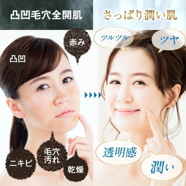 にきび クリーム オールインワン ゲル ニキビ ケア 薬用 ACNE FORCE AQUA アクネケア 肌荒れ 吹き出物 背中 お尻 ニキビ跡 顎ニキビ RESESTA 50g［医薬部外品］｜asahiyanet｜08