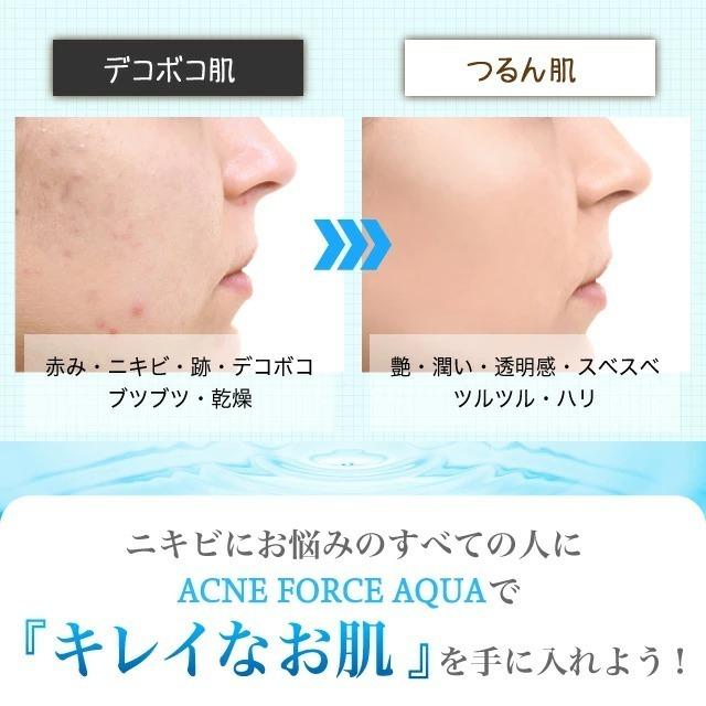 にきび クリーム オールインワン ゲル ニキビ ケア 薬用 ACNE FORCE AQUA アクネケア 肌荒れ 吹き出物 背中 お尻 ニキビ跡 顎ニキビ RESESTA 50g［医薬部外品］｜asahiyanet｜12