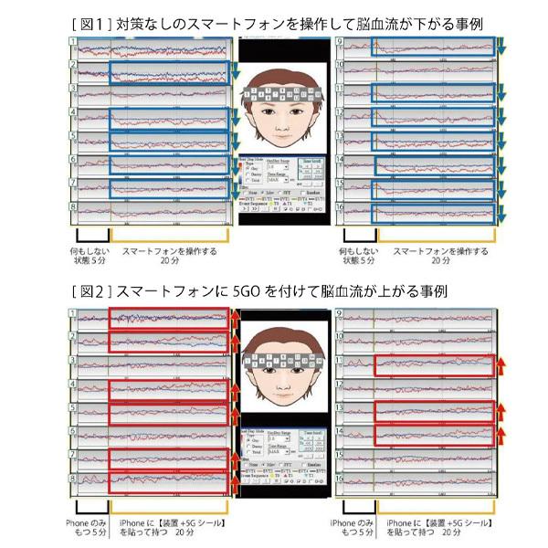5GO Lightning 電磁波保護 5GO Lightning（ゴーゴー ライトニング）タイプ｜トータルヘルス