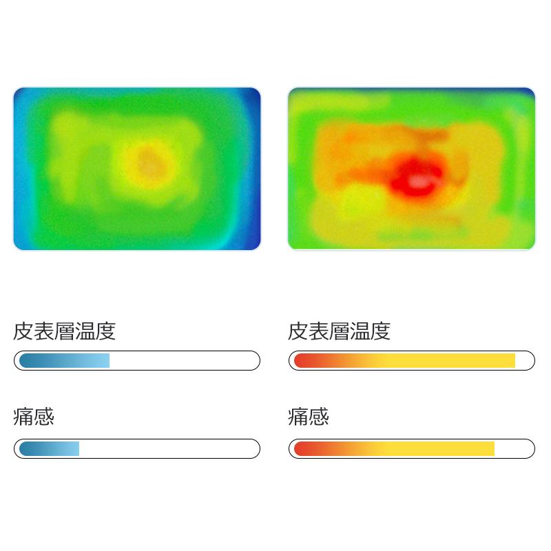 IPL高速脱毛 360°冷却 脱毛器 冷却 99万発照射 IPL光脱毛器 光美容器 照射モード 美肌 5段階レベル ムダ毛処理 快速脱毛 LCD表示 肌センサー(B1SMK208B)｜askrtech｜05