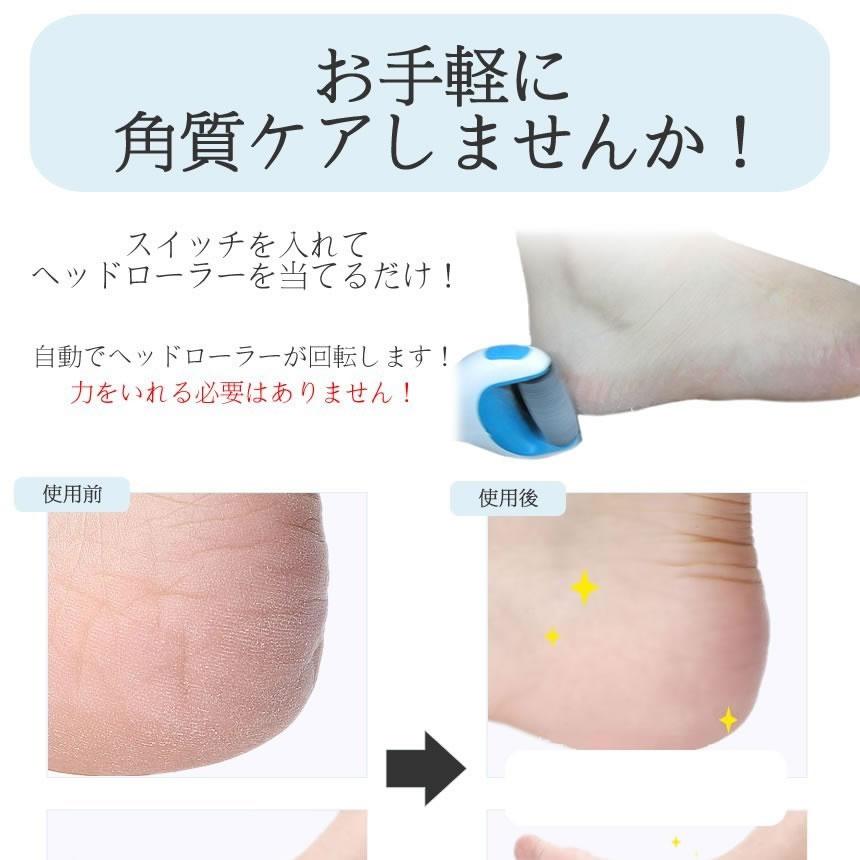 電動フットケア 楽天市場】☆注目商品☆送料無料 !(メール便) 電動角質リムーバー 防滴