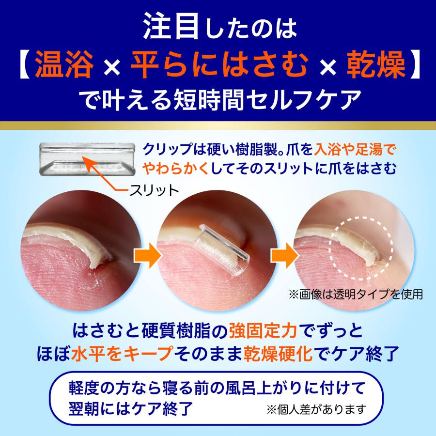 巻き爪用 ケアセット 硬質樹脂製クリップによる強固定力×温浴で巻き爪ケアが変わる