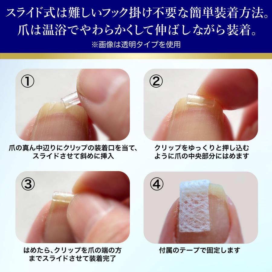 CURL NAIL巻き爪クリスタルケア【巻き爪もトゲも平らに固める】巻き爪