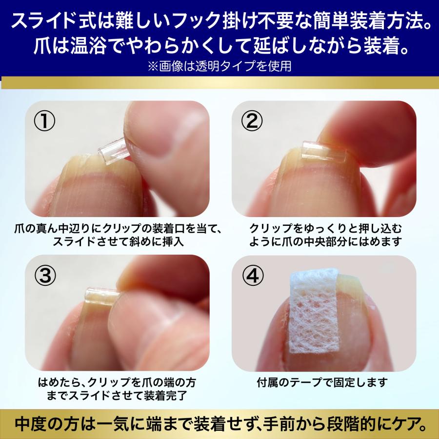 巻き爪もトゲも平らに固める【CURL NAIL 巻き爪クリスタルケア】日本製