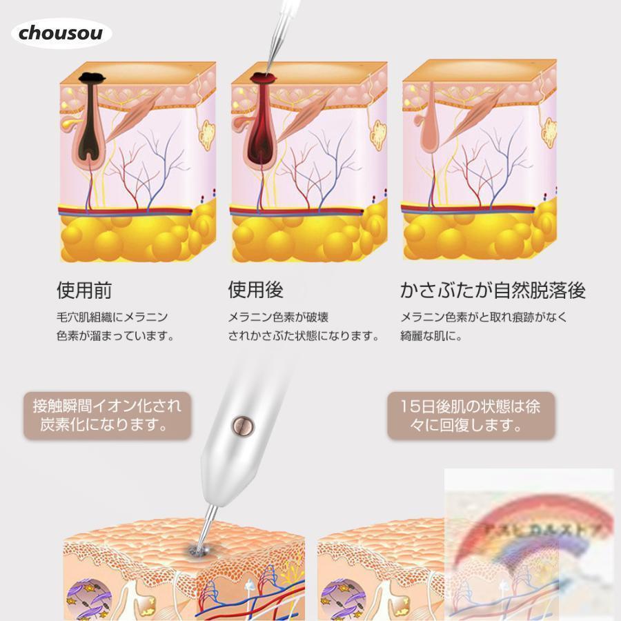 お肌の気になる部分をなんとかしたい！低周波美顔機シミ取りホクロ取り新品未使用 お肌の気になる部分をなんとかしたい！低周波美顔機シミ取り