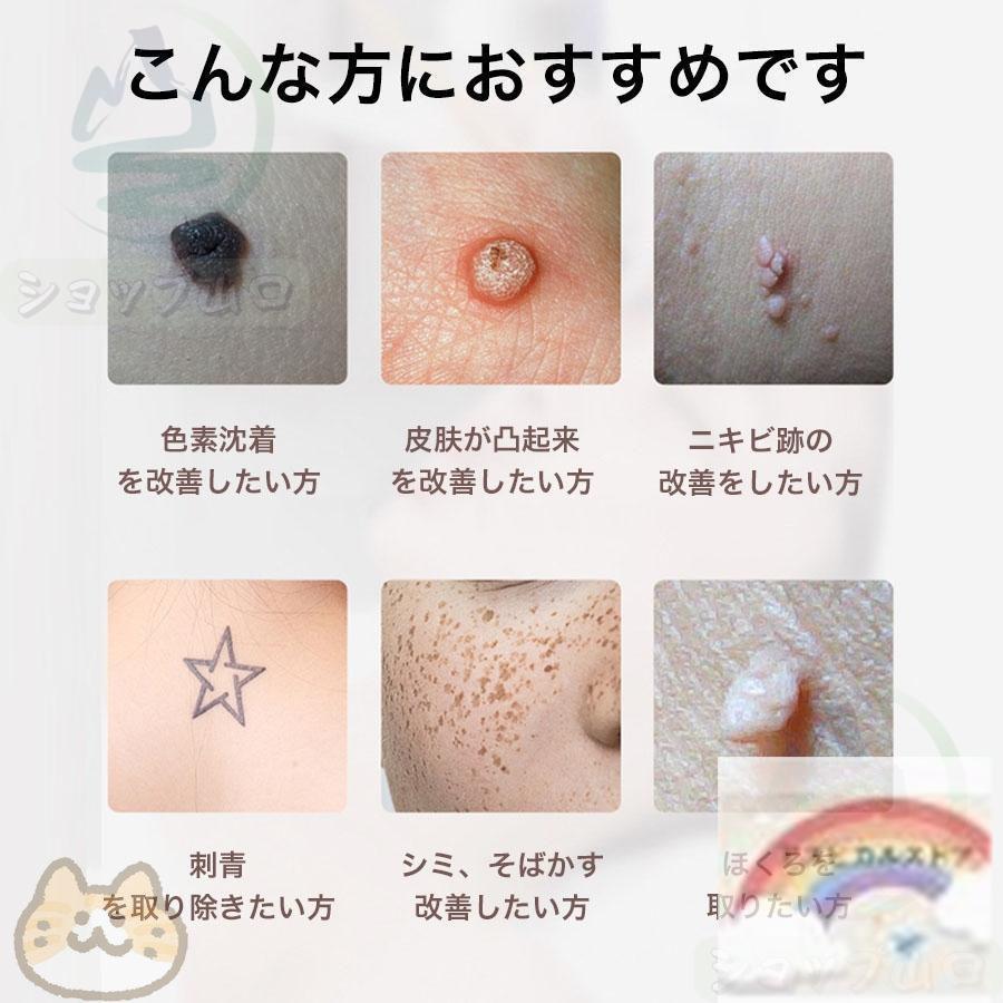 ピコレーザー レーザーペン シミ取り そばかす除去 青色レーザー ピコレーザー 美顔器 レーザーペン シミ取り ほくろそばかす除去