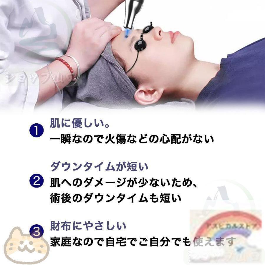 ピコレーザー レーザーペン シミ取り そばかす除去 青色レーザー ピコレーザー 美顔器 レーザーペン シミ取り ほくろそばかす除去