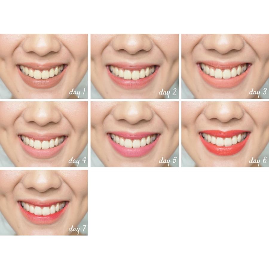 スパークル sparkle ホワイトニングキット whitening kit 30g paste